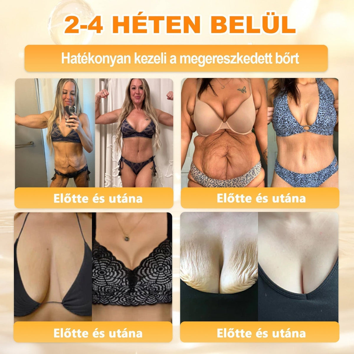 🌿💖 𝖠𝖯𝖪𝖠𝖯𝖪® Cremă regeneratoare pentru piele cu venin de albine (Certificare CE)  ✅