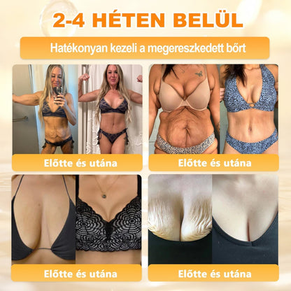 🌿💖 𝖠𝖯𝖪𝖠𝖯𝖪® Cremă regeneratoare pentru piele cu venin de albine (Certificare CE)  ✅