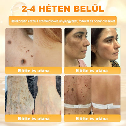 🌿💖 𝖠𝖯𝖪𝖠𝖯𝖪® Cremă regeneratoare pentru piele cu venin de albine (Certificare CE)  ✅