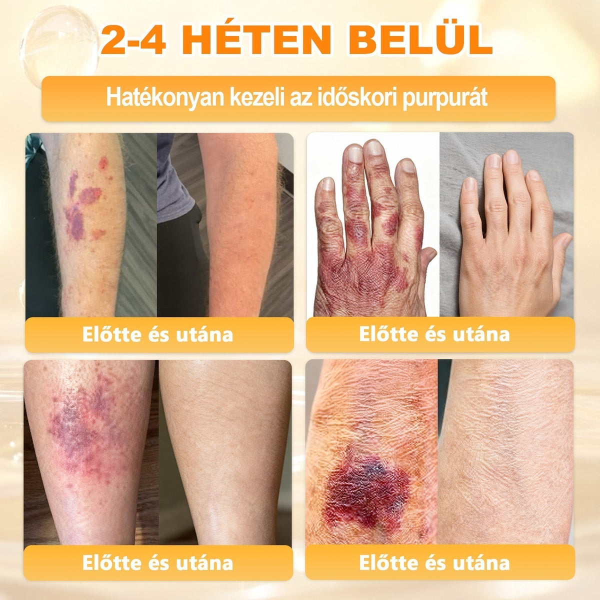 🌿💖 𝖠𝖯𝖪𝖠𝖯𝖪® Cremă regeneratoare pentru piele cu venin de albine (Certificare CE)  ✅