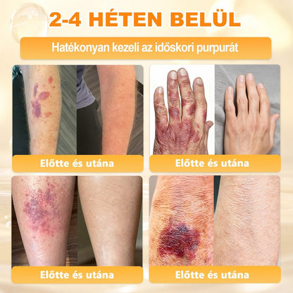 🌿💖 𝖠𝖯𝖪𝖠𝖯𝖪® Cremă regeneratoare pentru piele cu venin de albine (Certificare CE)  ✅