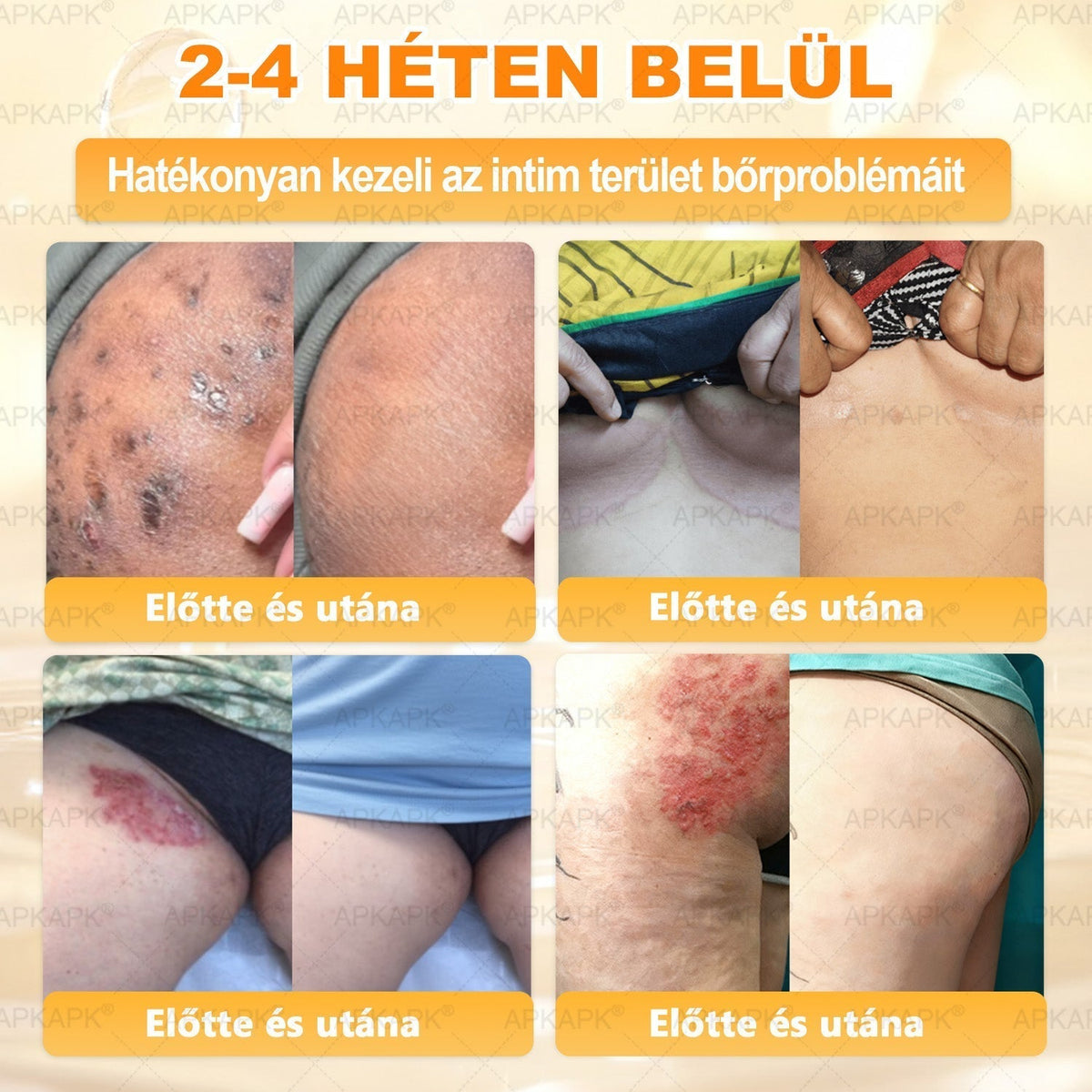 🌿💖 𝖠𝖯𝖪𝖠𝖯𝖪® Cremă regeneratoare pentru piele cu venin de albine (Certificare CE)  ✅
