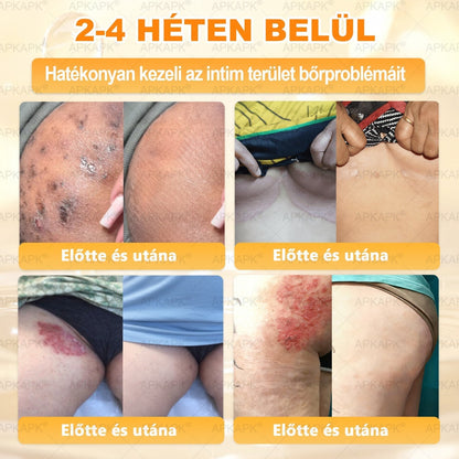 🌿💖 𝖠𝖯𝖪𝖠𝖯𝖪® Cremă regeneratoare pentru piele cu venin de albine (Certificare CE)  ✅