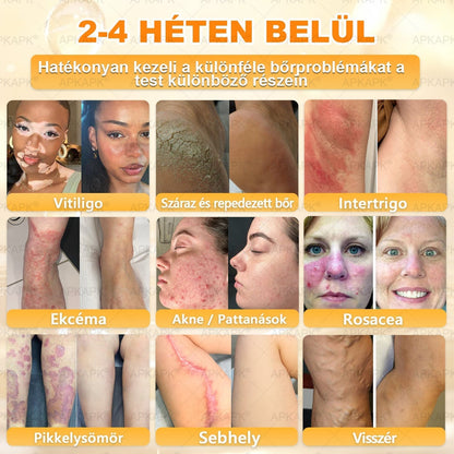 🌿💖 𝖠𝖯𝖪𝖠𝖯𝖪® Cremă regeneratoare pentru piele cu venin de albine (Certificare CE)  ✅
