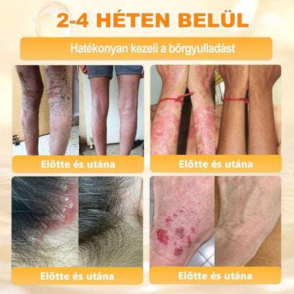 🌿💖 𝖠𝖯𝖪𝖠𝖯𝖪® Cremă regeneratoare pentru piele cu venin de albine (Certificare CE)  ✅