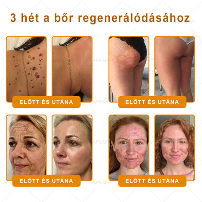 🌿💖 𝖠𝖯𝖪𝖠𝖯𝖪® Cremă regeneratoare pentru piele cu venin de albine (Certificare CE)  ✅