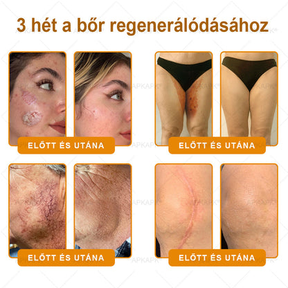 🌿💖 𝖠𝖯𝖪𝖠𝖯𝖪® Cremă regeneratoare pentru piele cu venin de albine (Certificare CE)  ✅