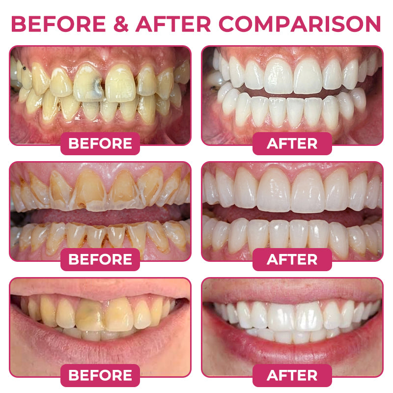 🌿🦷𝑹𝒐𝒍𝒊𝒎𝒆𝒚® 𝑫𝒆𝒏𝑷𝒆𝒓𝒎 𝑮𝒆𝒍 𝑵𝒂𝒕𝒖𝒓𝒂𝒍 𝒑𝒆𝒏𝒕𝒓𝒖 𝑹𝒆𝒑𝒂𝒓𝒂𝒓𝒆𝒂 𝑪𝒂𝒓𝒊𝒊𝒍𝒐𝒓 ș𝒊 𝑹𝒆𝒇𝒂𝒄𝒆𝒓𝒆𝒂 𝑺𝒎𝒂𝒍ț𝒖𝒍𝒖𝒊