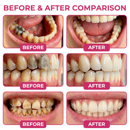 🌿🦷𝑹𝒐𝒍𝒊𝒎𝒆𝒚® 𝑫𝒆𝒏𝑷𝒆𝒓𝒎 𝑮𝒆𝒍 𝑵𝒂𝒕𝒖𝒓𝒂𝒍 𝒑𝒆𝒏𝒕𝒓𝒖 𝑹𝒆𝒑𝒂𝒓𝒂𝒓𝒆𝒂 𝑪𝒂𝒓𝒊𝒊𝒍𝒐𝒓 ș𝒊 𝑹𝒆𝒇𝒂𝒄𝒆𝒓𝒆𝒂 𝑺𝒎𝒂𝒍ț𝒖𝒍𝒖𝒊